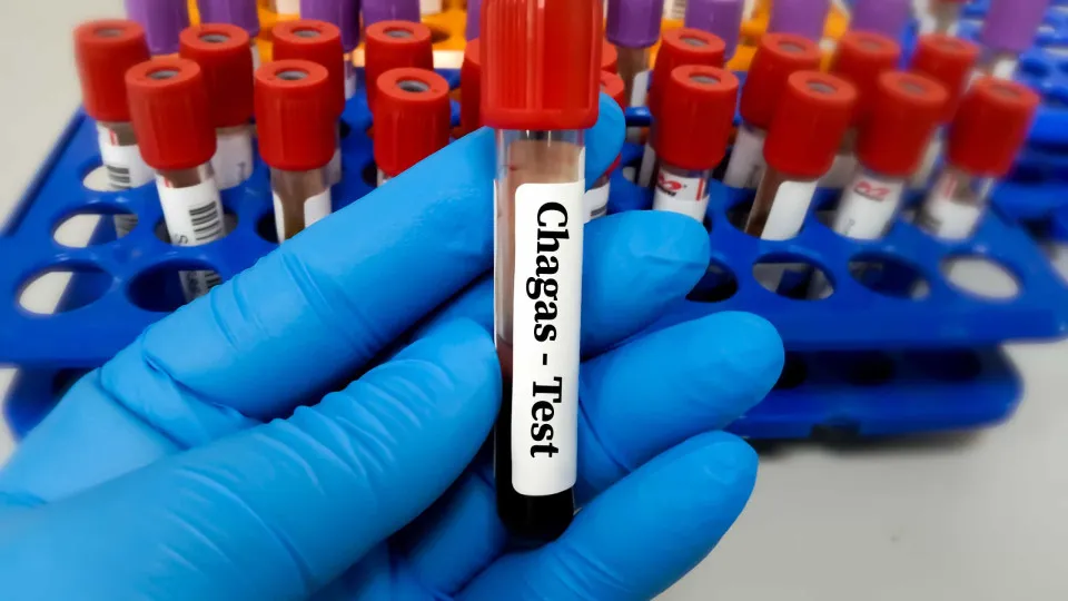 Brasil segue líder mundial em mortes por Chagas, apesar da queda de casos e óbitos