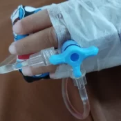 Criança de 10 anos perde a visão de um olho após agressão em escola do Rio