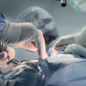 Gêmeos siameses morrem após cirurgia de separação em Goiânia