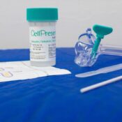 Guia orienta sobre mudança de rastreamento do câncer de colo do útero