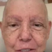 Roseana Sarney é internada com pneumonia durante tratamento contra câncer