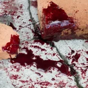 Criança morre após ser atingida por queda de muro em Itapevi, na Grande São Paulo