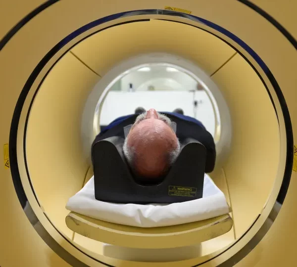 Alzheimer é a segunda doença mais temida pelos brasileiros, atrás apenas do câncer