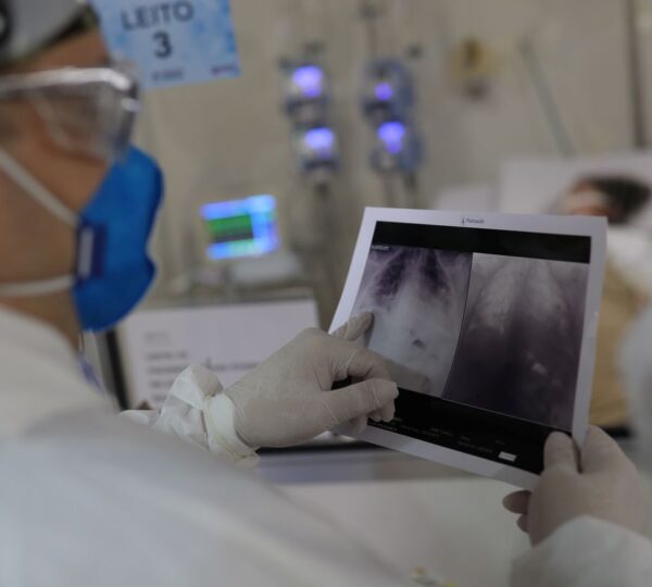 Broncopneumonia: entenda quadro que causou internação de Bolsonaro