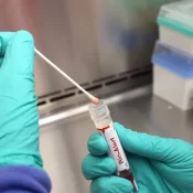 Casos de mpox mais que dobram em 20 dias, com 129 confirmações no Brasil