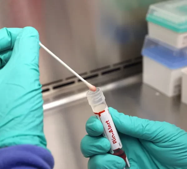 Casos de mpox mais que dobram em 20 dias, com 129 confirmações no Brasil