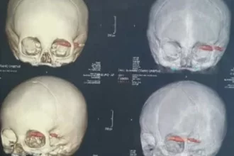 Cientistas acham crânios de 2.000 anos, e detalhe nos dentes chama atenção