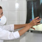 OMS recomenda testes de diagnóstico rápido para erradicar tuberculose