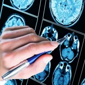 Mais de 50% dos diagnósticos de autismo ocorrem antes dos 5 anos de idade