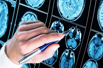 Mais de 50% dos diagnósticos de autismo ocorrem antes dos 5 anos de idade