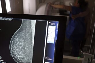 Nova lei reforça direito a três folgas por ano para exames preventivos