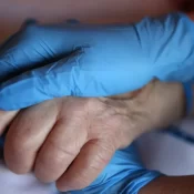 Vírus sincicial também traz risco para idosos, alertam especialistas