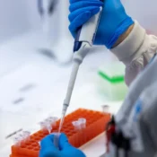 Detecção de variantes de coronavírus no esgoto pode antecipar alta de internações por Covid