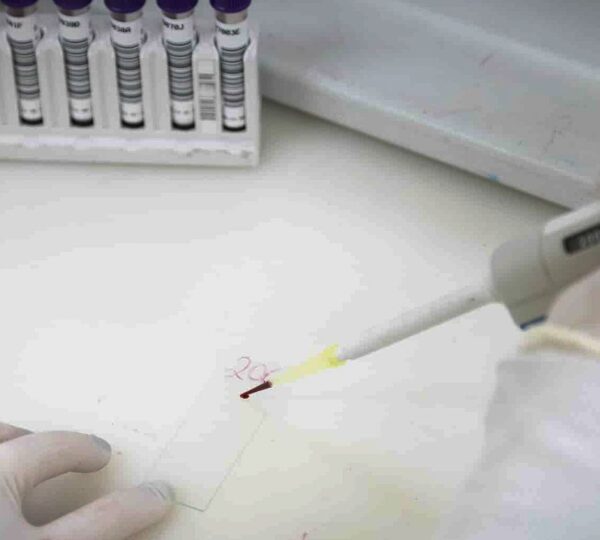 Paciente em SP com suspeita de ebola testa positivo para meningite