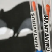 Paraná confirma dois casos de hantavírus e investiga outros 11