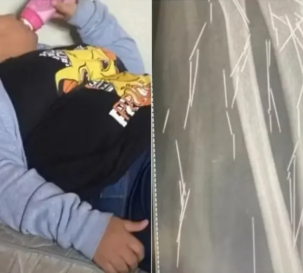 Mulher que fingiu ter 12 anos relatou agulhas no corpo