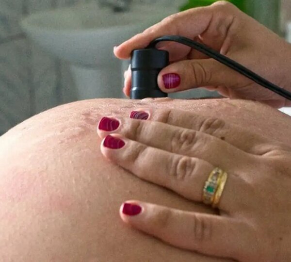 Risco de morte materna cai até 31% entre quem recebe o Bolsa Família